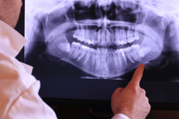 Best Emergency Tooth Extraction in Newport, AR
